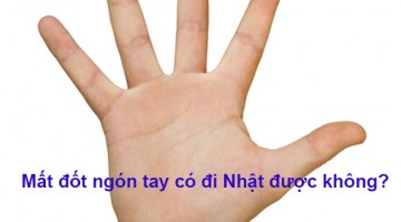 mất đốt ngón tay có đi nhật được không