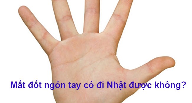 mất đốt ngón tay có đi nhật được không